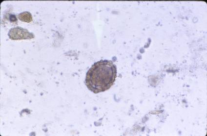 Toxocara