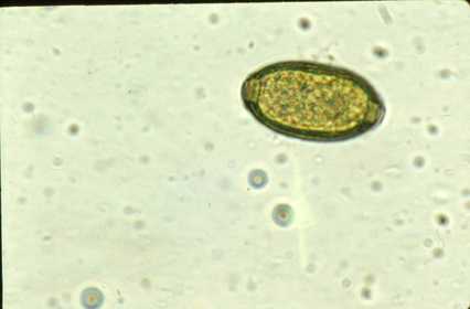 Trichuris