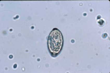 Trichuris