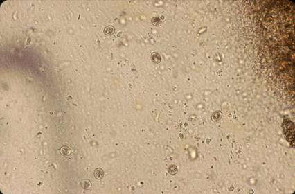 Protozoa Coccidia
