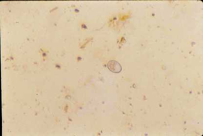 Protozoa Coccidia