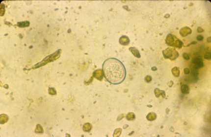 Protozoa Coccidia
