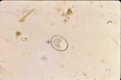 Protozoa Coccidia