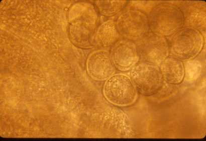 Cestodes Dipylidium