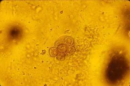 Cestodes Dipylidium