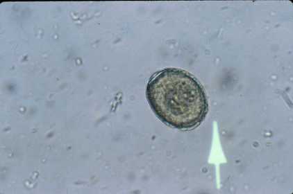 Trematode Fluke