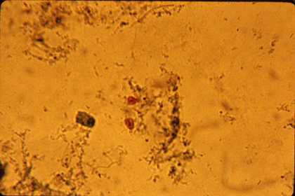 Protozoa Giardia Trophozoite
