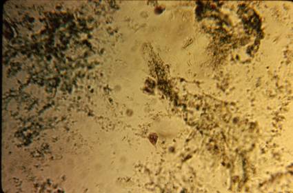 Protozoa Giardia Trophozoite