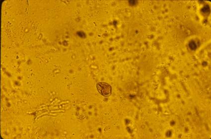 Protozoa Giardia Trophozoite