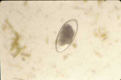 Strongyle