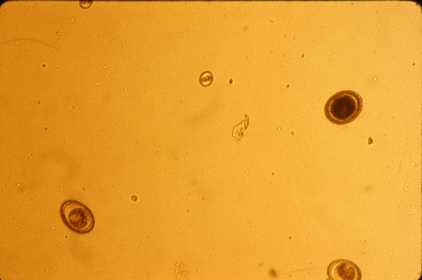 Toxocara and Coccidia