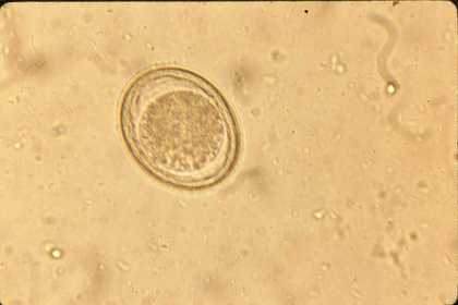 Toxocara