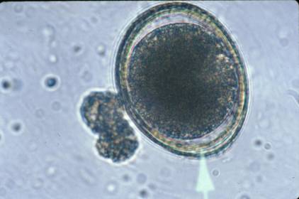 Toxocara