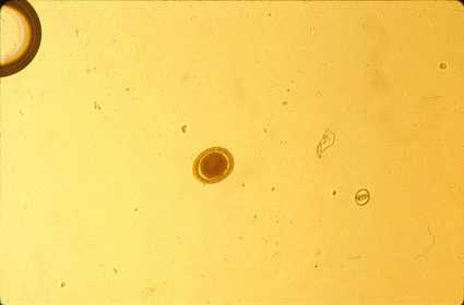 Toxocara and Coccidia