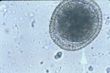 Toxocara