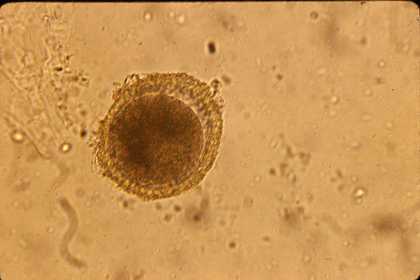 Toxocara