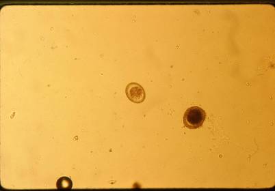 Toxocara