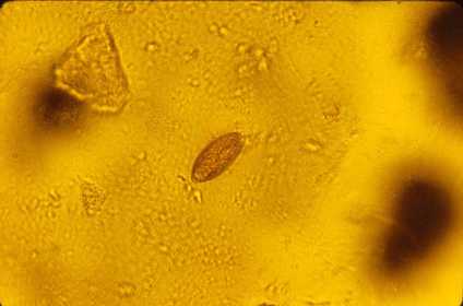 Trichuris