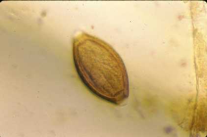 Trichuris