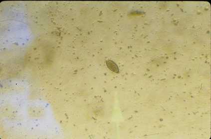 Trichuris