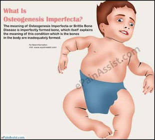 Colagenopatias imágenes