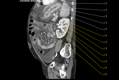ANATOMIA RADIOLÓGICA DO ABDOMEM