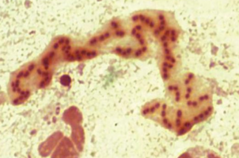 Diagnostico de P. aeruginosa por ventilacion mecanica