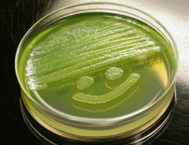 Diagnostico de P. aeruginosa por ventilacion mecanica