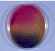 Diagnostico de P. aeruginosa por ventilacion mecanica
