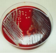 Diagnostico de P. aeruginosa por ventilacion mecanica