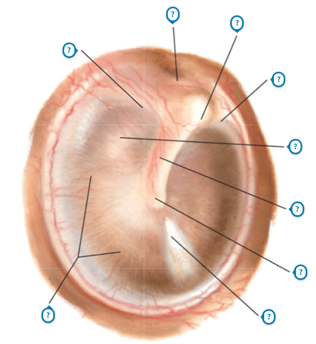 Basic Anatomy of the Ear and Otoscopic View of Right Tympanic Membrane
