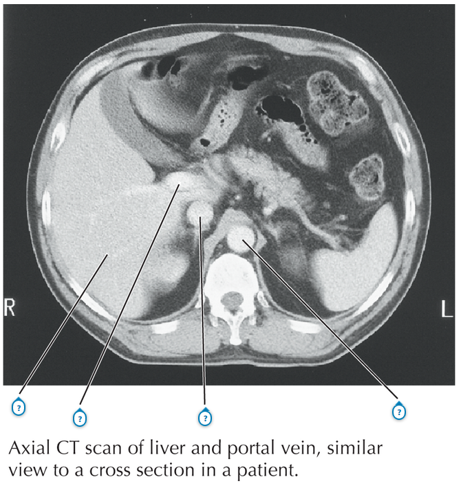 Anatomy and Basic Functions of the Liver and Bilirubin Metabolism