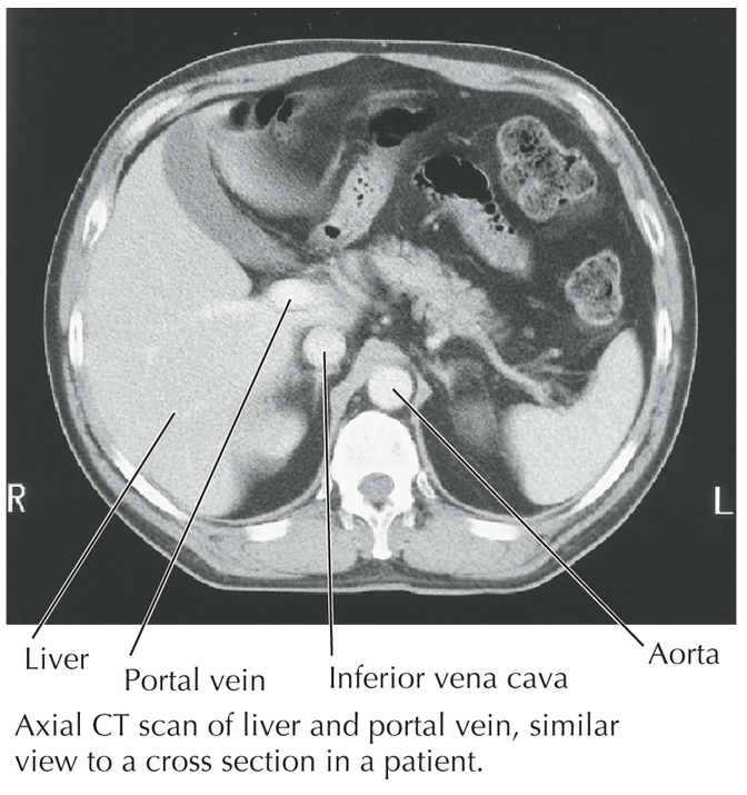 Anatomy and Basic Functions of the Liver and Bilirubin Metabolism