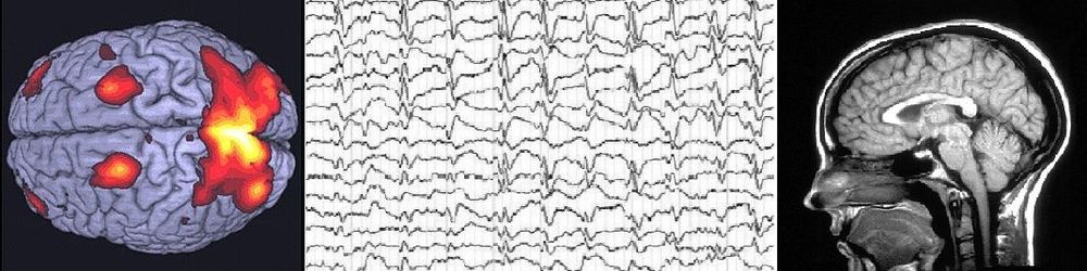 Image for question 6