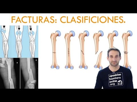 CLASIFICACIÓN DE FRACTURAS ABIERTAS