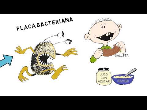 CARIES DENTAL DIAGNOSTICO DIFERENCIAL