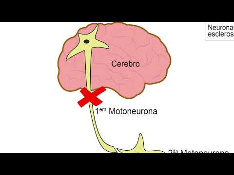 UD2_8.Patologías cerebrales