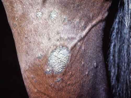 COSTRAS Formadas cuando exudado seco, suero, pus, sangre, células, escamas o medicamentos, se adhieren a la superficie del piel.