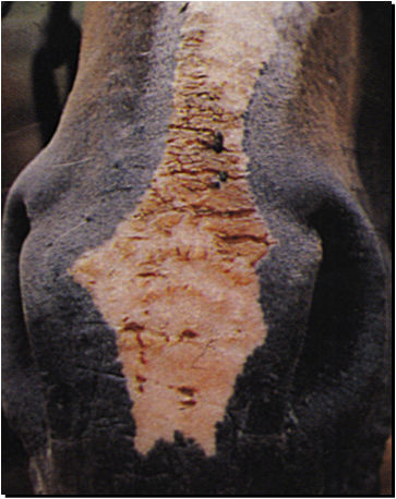 FISURAS