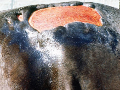 ÚLCERA Un defecto más profundo que alcanza la membrana basal de la epidermis, exponiendo la dermis subyacente y posiblemente el tejido su...