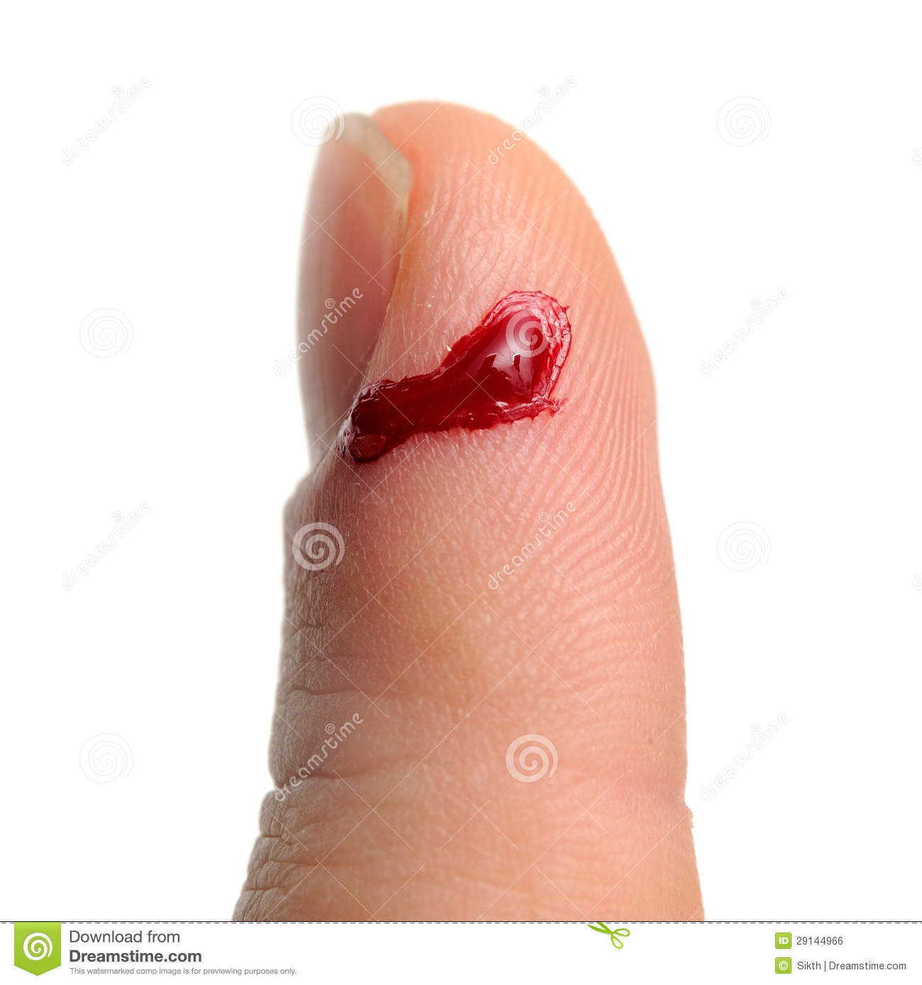 bleed