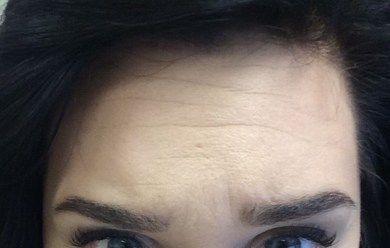 MY FOREHEAD-5 My forehead is beautiful, its color is pink. and my skin, is color pink too. Everyone have forehead, the forehead is locate...