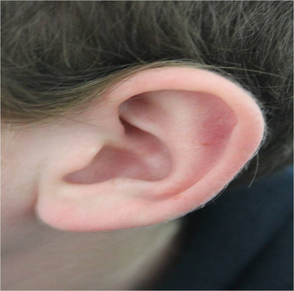 MY EARS -7- My ears are normal, many people have big ears. The ears are for lesten the music and the noise, my father has big ears, and m...