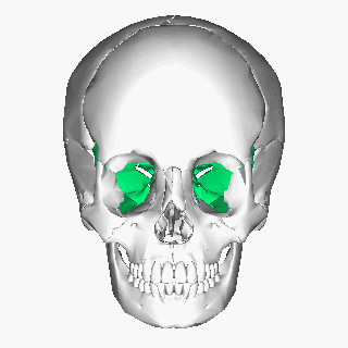 Sphenoid Bone Articulates with: 7 other cranial bones Zygoma