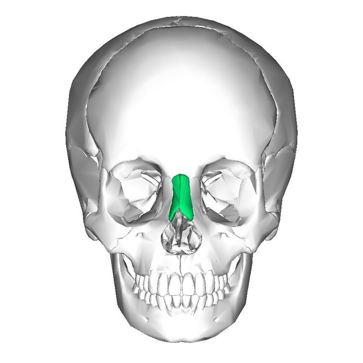 Nasal Bones Articulatations: Frontal Ethmoid Maxillae Opposite nasal bone at MSP