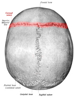 Coronal Suture