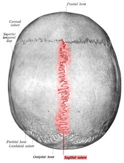 Sagittal Suture