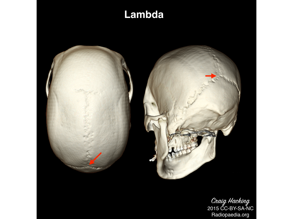 Lambda