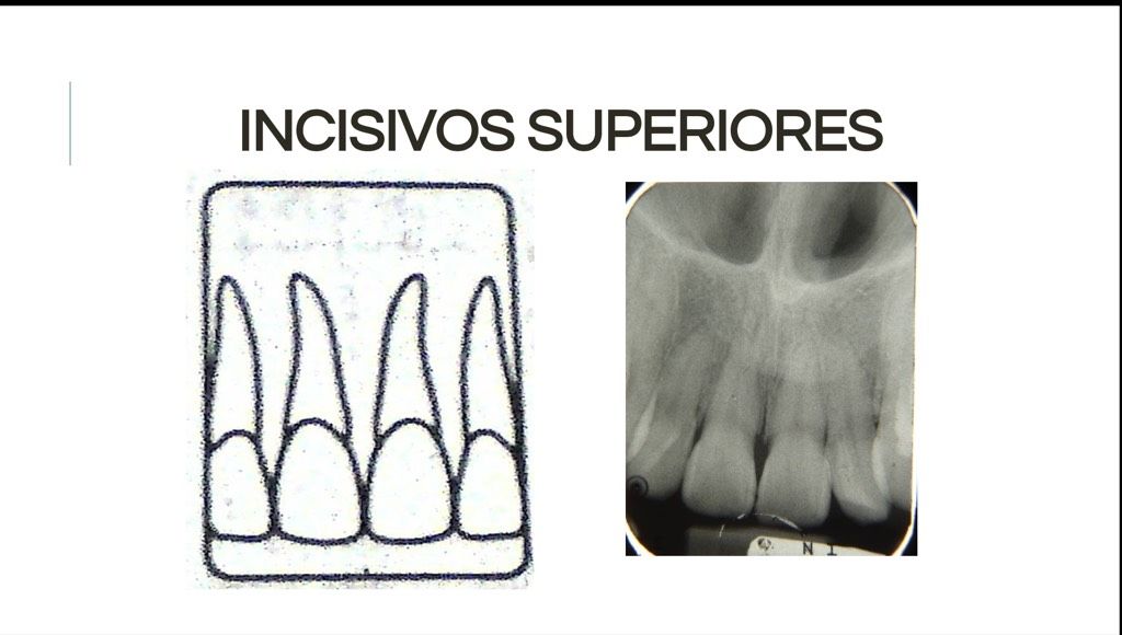 Áreas Prescritas