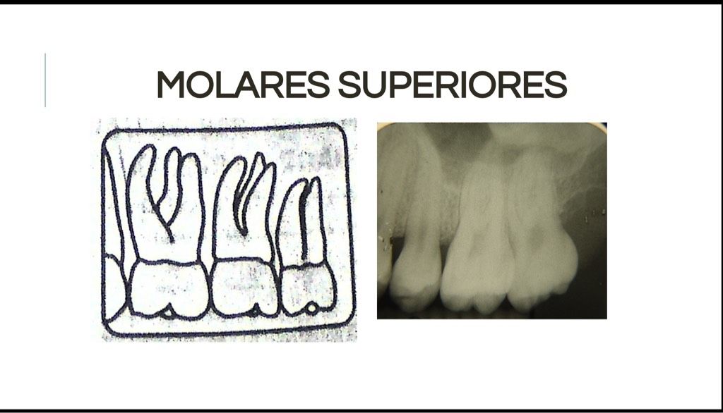 Áreas Prescritas